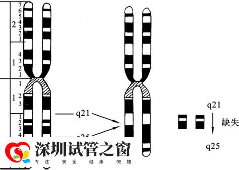 染色体异常可以生出正常的小孩吗？三代试管成为首选