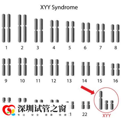 染色体异常可以生出正常的小孩吗？三代试管成为首选